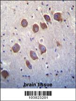 DGKQ Antibody (C-term)