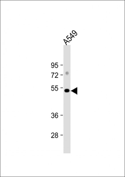 GSK3 alpha (GSK3A) Antibody (C-term)