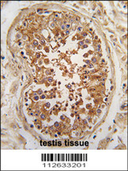 ULK3 Antibody (N-term)