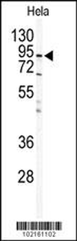 IKK beta Antibody