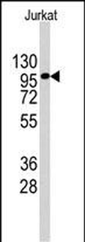 APG1 (ULK1) Antibody (Center)