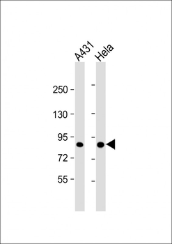 TLK1 Antibody (C-term)