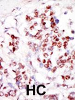 TLK1 Antibody (C-term)