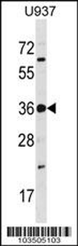 PRPK Antibody (Center)