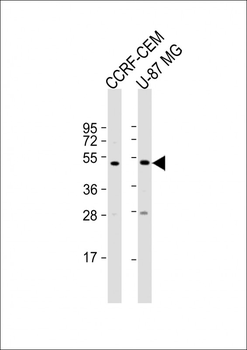 Protein Kinase A regulatory subunit I alpha Antibody (N-term)
