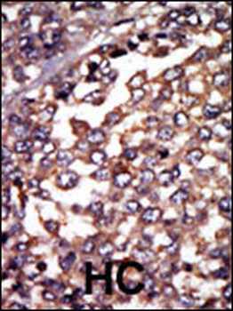 Protein Kinase A regulatory subunit I alpha Antibody (N-term)