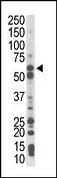 PCK1 Antibody (N-term)