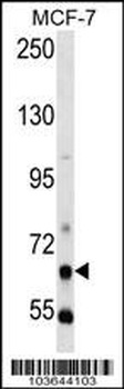 PCK1 Antibody (N-term)