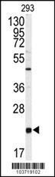 PBP Antibody (Center)
