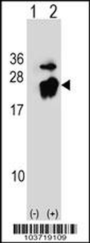 PBP Antibody (Center)