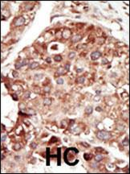 PBP Antibody (Center)