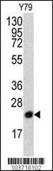 PBP Antibody (N-term)