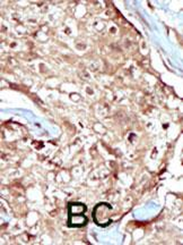 PAPSS2 Antibody (C-term)