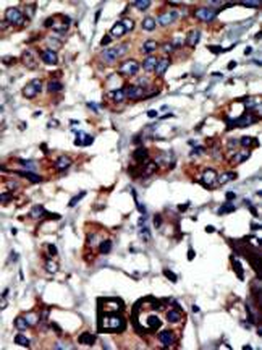 PACSIN3 Antibody (N-term)