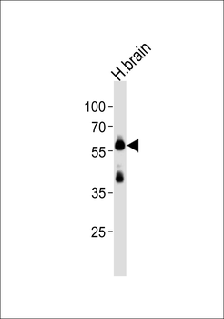 PACSIN1 Antibody (Center)