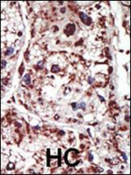 PACSIN1 Antibody (Center)