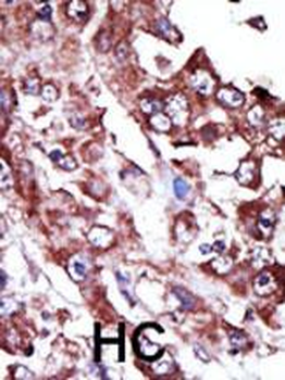 NME7 Antibody (N-term)