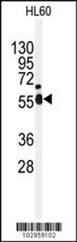 NEK2 Antibody (Center)