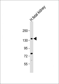 NEK1 Antibody (C-term)