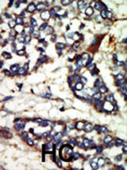 NEK1 Antibody (C-term)