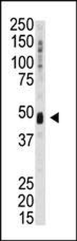 KIST (KIS) Antibody (N-term)