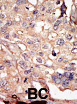 ARK5 Antibody (N-term)