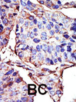 BGLF4 Antibody (C-term)