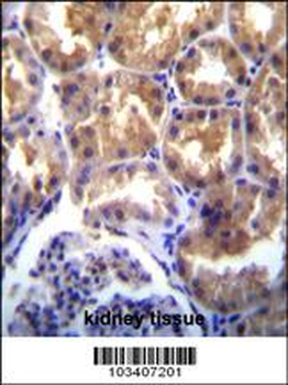 TRPM6 (CHAK2) Antibody (Center)