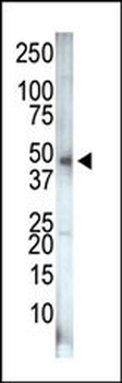 PIP5K2G Antibody (C-term)
