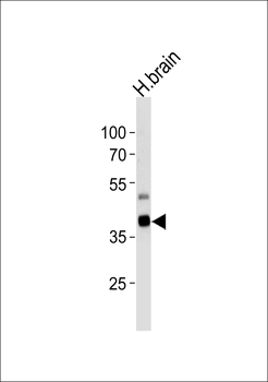 PIP5K2G Antibody (C-term)