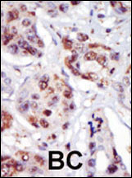 PIP5K2G Antibody (C-term)