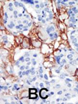 PIP5K2B Antibody (C-term)