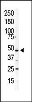 PIP5K2 Alpha (PIP5K2A) Antibody (C-term)