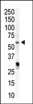 PIP5K1A Antibody (N-term)