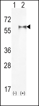 PIP5K1A Antibody (N-term)