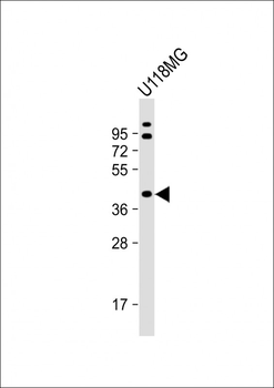 Endophilin B1 Antibody (Y80)