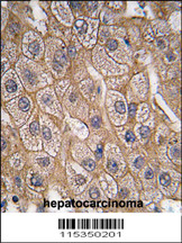 Endophilin B1 Antibody (Y80)