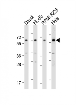 PI 4 Kinase type 2 beta antibody (C-term)