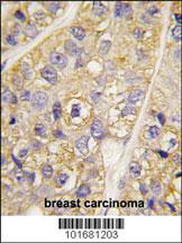 PI 4 Kinase type 2 beta antibody (N-term)