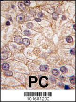 PI 4 Kinase type 2 beta antibody (N-term)