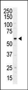 PI4K2A (PI4K II) Antibody (N-term)