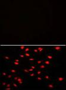 PI4K2A (PI4K II) Antibody (N-term)