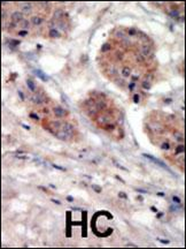 PI4K2A (PI4K II) Antibody (N-term)