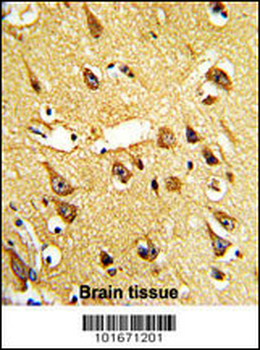 PI4KCA Antibody (N-term)