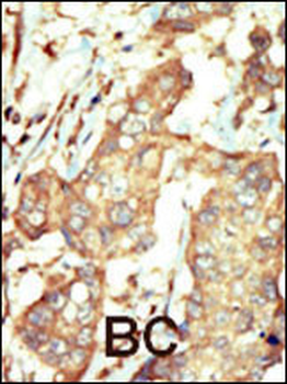PI4KCA Antibody (N-term)