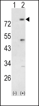 PI3KR5 Antibody (Center)
