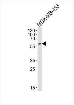 PIK3R3 Antibody (C-term)