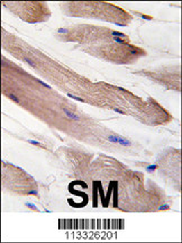 PIK3R1 Antibody (Y580)