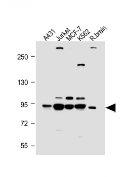 PI3KR1 Antibody (N-term L11)