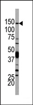 PI3KCD Antibody (N-term)